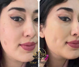 کرم پودر پد دار لاکچری کوین اصل
