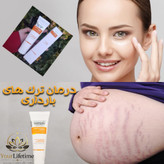 کرم بیوممتیک رفع ترک های پوستی گاتیو ( استرچ مارک ) - ۱۰۰ میل