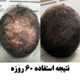 سرم سیر سیاه لاکچری کوین -اصل 30میل