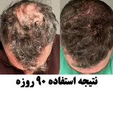سرم سیر سیاه لاکچری کوین -اصل 30میل