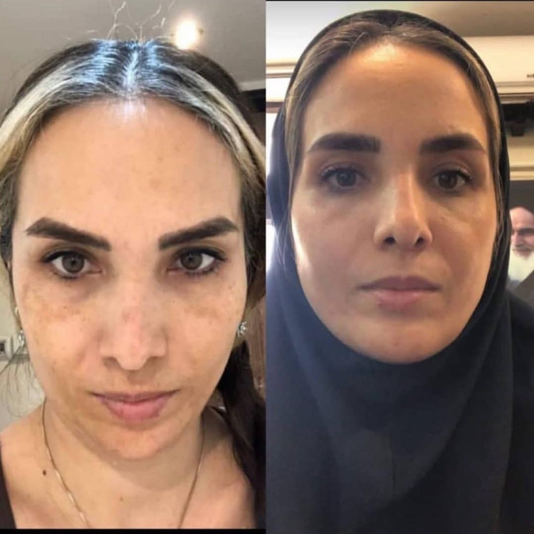 پک ضد لک فوری اصل فرانسه
